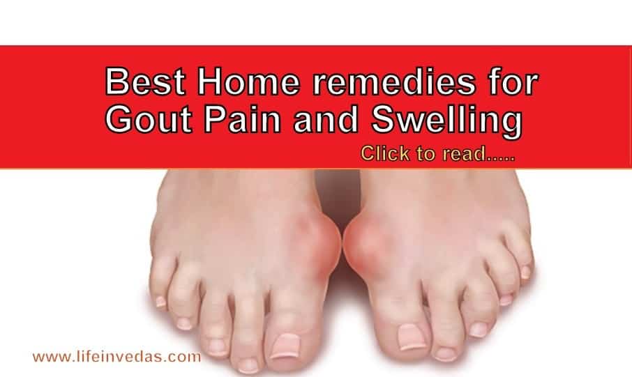 natural home remedies for gout