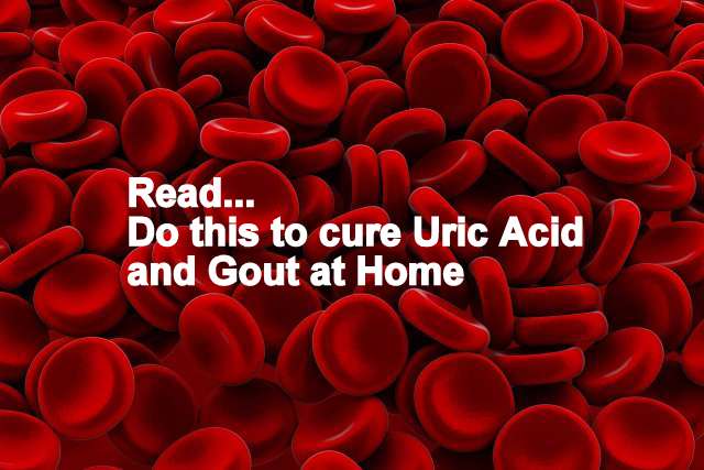 uric acid treatment